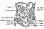 用“胸膜炎”造句